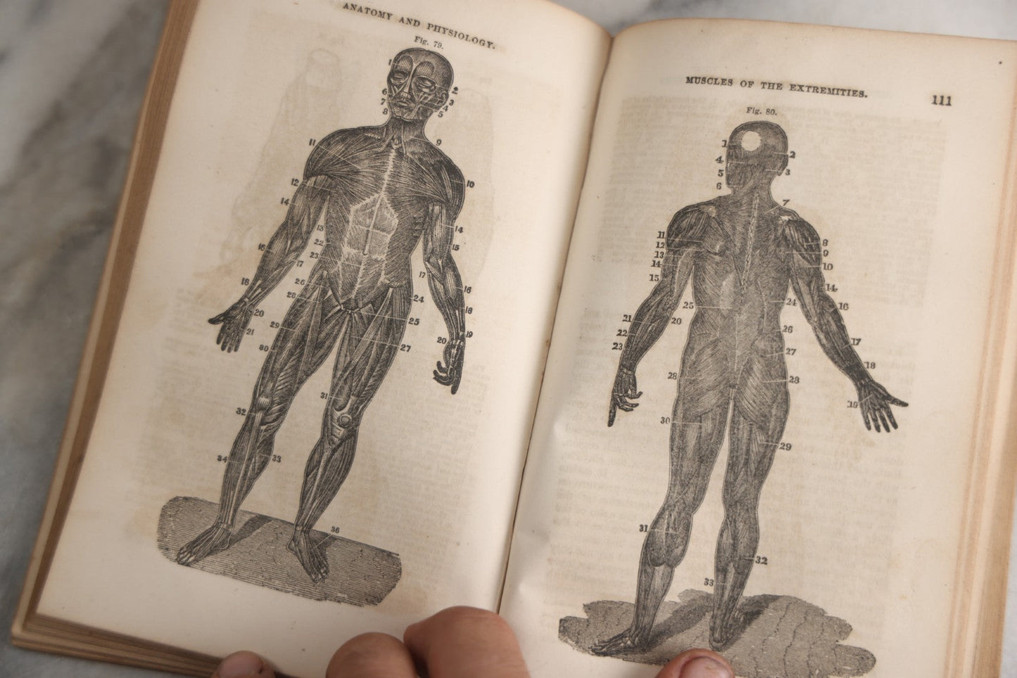 Lot 171 - "Anatomy And Physiology: Designed For Academies And Families" Antique Medical Book By Calvin Cutter, M.D., Sixth Stereotype Edition, Illustrated With Over 200 Engravings, Benjamin B. Mussey & Co., Publishers, Boston, 1847, Note Missing Covers