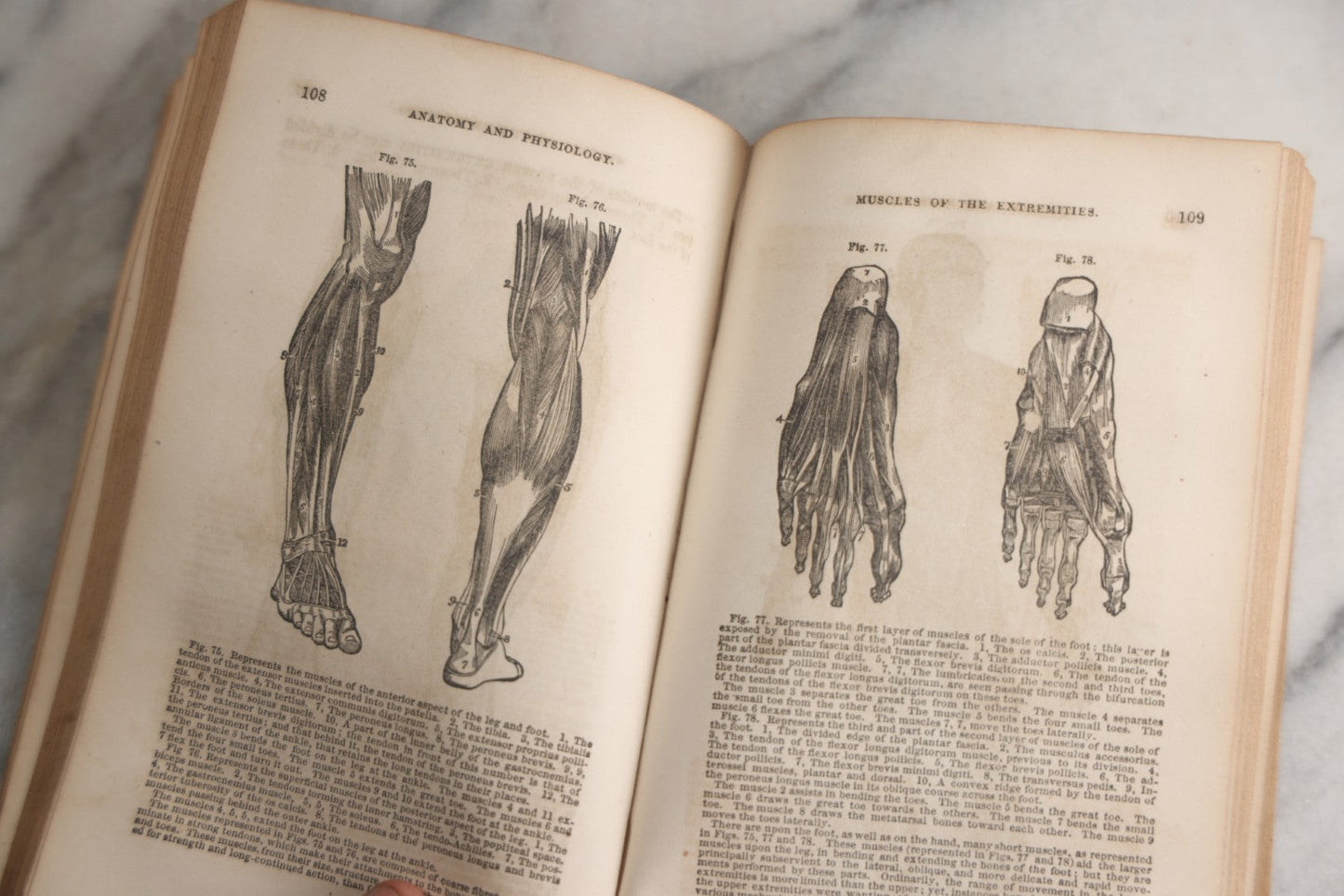 Lot 171 - "Anatomy And Physiology: Designed For Academies And Families" Antique Medical Book By Calvin Cutter, M.D., Sixth Stereotype Edition, Illustrated With Over 200 Engravings, Benjamin B. Mussey & Co., Publishers, Boston, 1847, Note Missing Covers