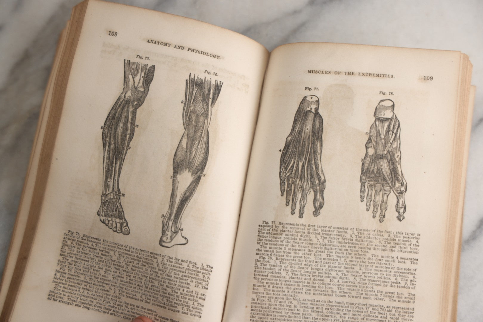 Lot 171 - "Anatomy And Physiology: Designed For Academies And Families" Antique Medical Book By Calvin Cutter, M.D., Sixth Stereotype Edition, Illustrated With Over 200 Engravings, Benjamin B. Mussey & Co., Publishers, Boston, 1847, Note Missing Covers