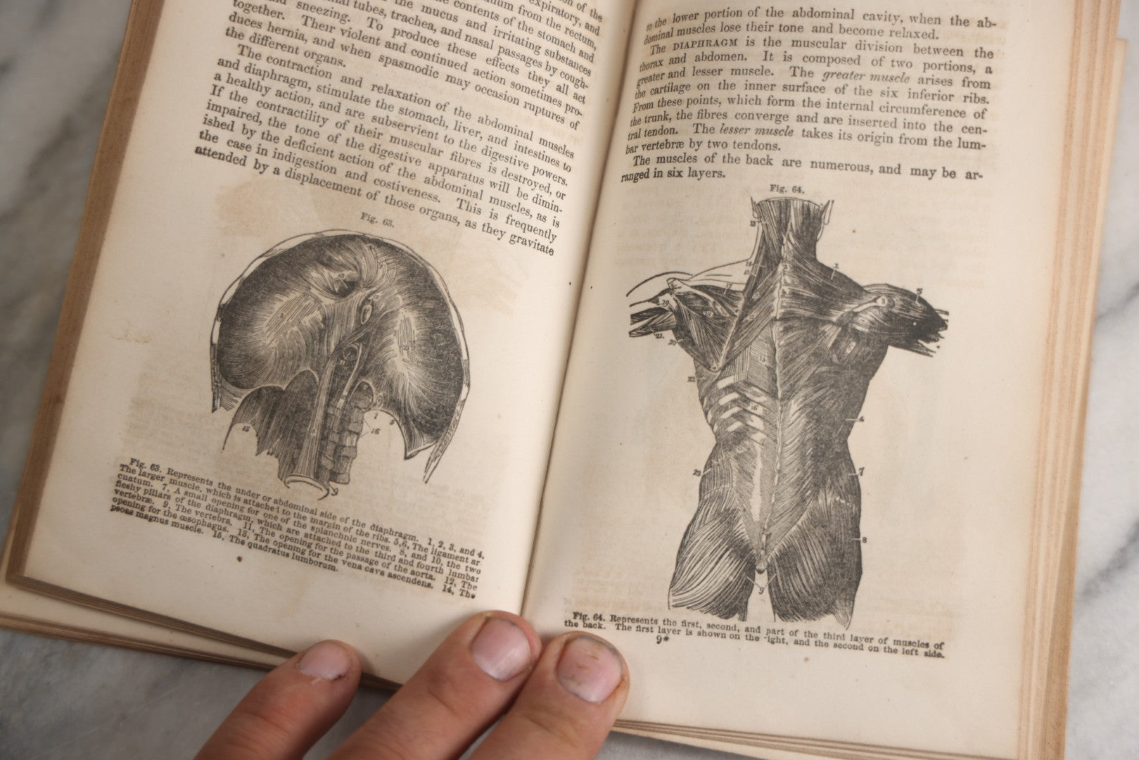 Lot 171 - "Anatomy And Physiology: Designed For Academies And Families" Antique Medical Book By Calvin Cutter, M.D., Sixth Stereotype Edition, Illustrated With Over 200 Engravings, Benjamin B. Mussey & Co., Publishers, Boston, 1847, Note Missing Covers