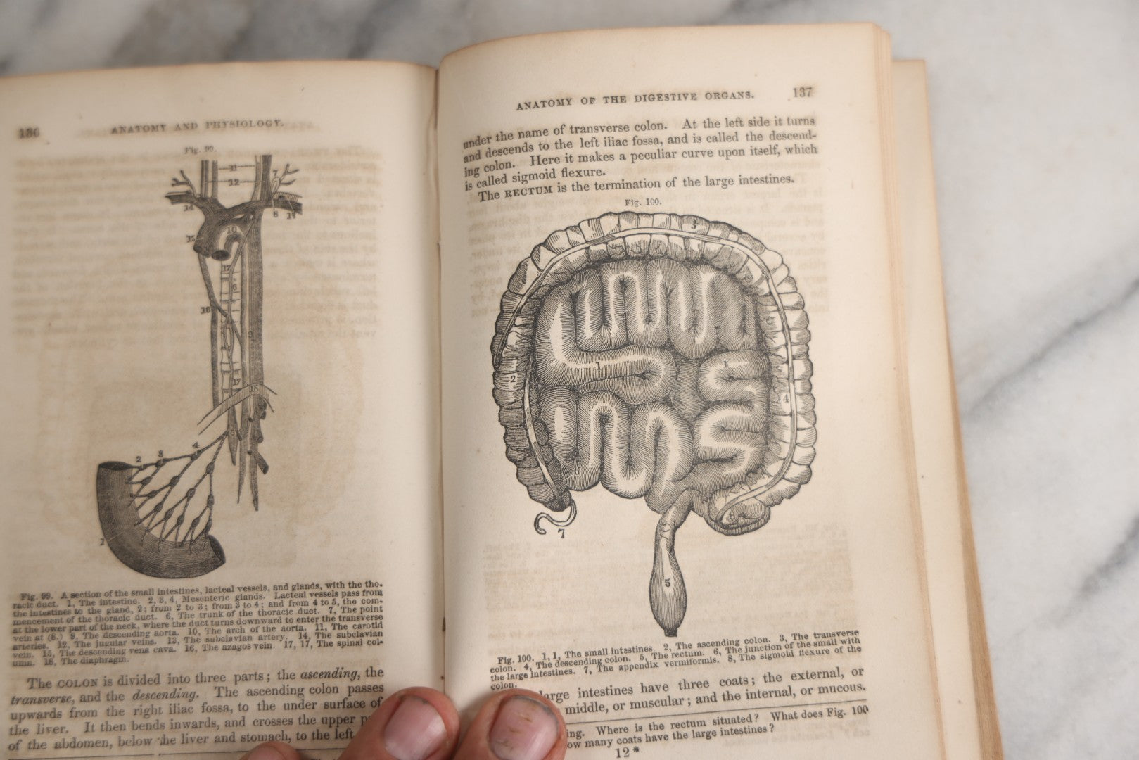Lot 171 - "Anatomy And Physiology: Designed For Academies And Families" Antique Medical Book By Calvin Cutter, M.D., Sixth Stereotype Edition, Illustrated With Over 200 Engravings, Benjamin B. Mussey & Co., Publishers, Boston, 1847, Note Missing Covers
