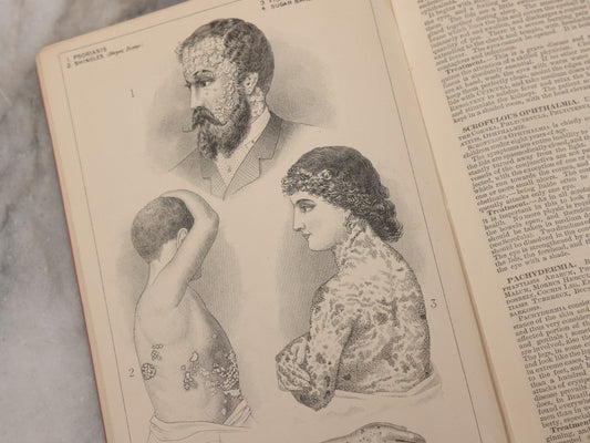 Lot 048 - "Diseases Of The Skin And Blood And How To Cure Them" Antique Illustrated Medical Booklet Prepared And Published By Potter Drug & Chemical Company, Boston, Massachusetts, 1885, Fourth Edition, With 37 Engravings "Drawn From Life"