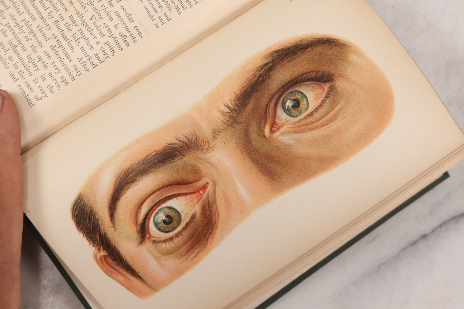Lot 049 - "Atlas Of The External Diseases Of The Eye Including [...] Pathology And Treatment" Antique Medical Book By Prof. Dr. O. Haab, Translated From German, Illustrated With 76 Plates & 6 Engravings, Published By W.B. Saunders, Philadelphia, 1899