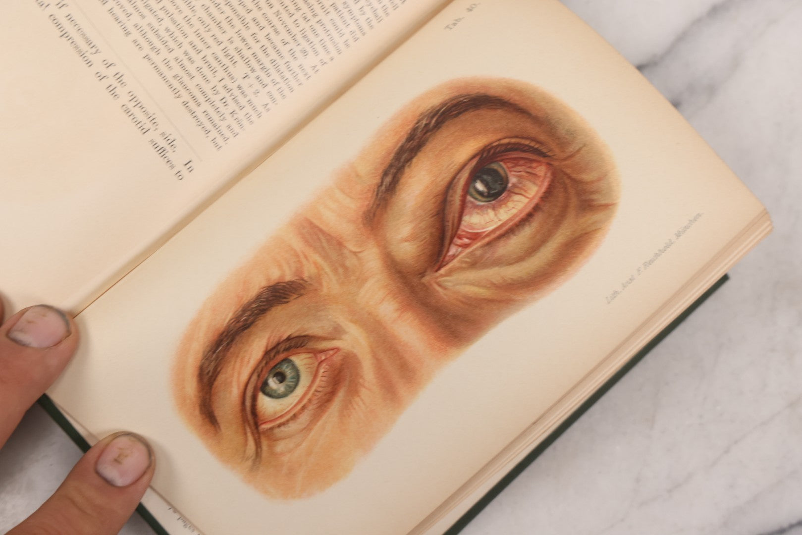 Lot 049 - "Atlas Of The External Diseases Of The Eye Including [...] Pathology And Treatment" Antique Medical Book By Prof. Dr. O. Haab, Translated From German, Illustrated With 76 Plates & 6 Engravings, Published By W.B. Saunders, Philadelphia, 1899