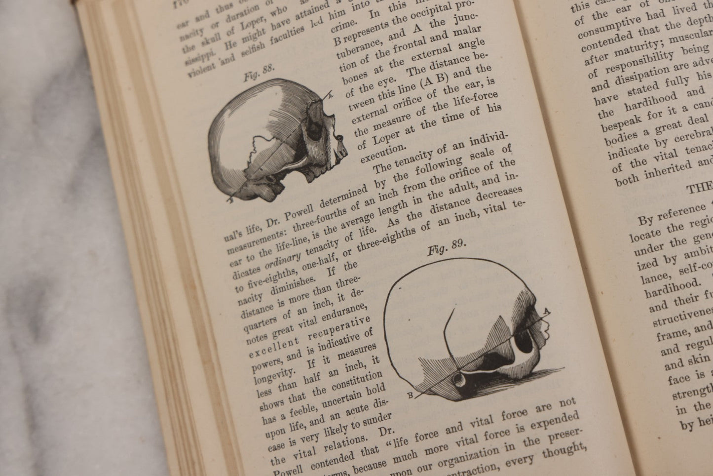 Lot 051 - "The People's Common Sense Medical Adviser In Plain English, Or, Medicine Simplified" Antique Illustrated Medical Book By R.V. Pierce, M.D., Seventy-First Edition, Buffalo, New York, 1895