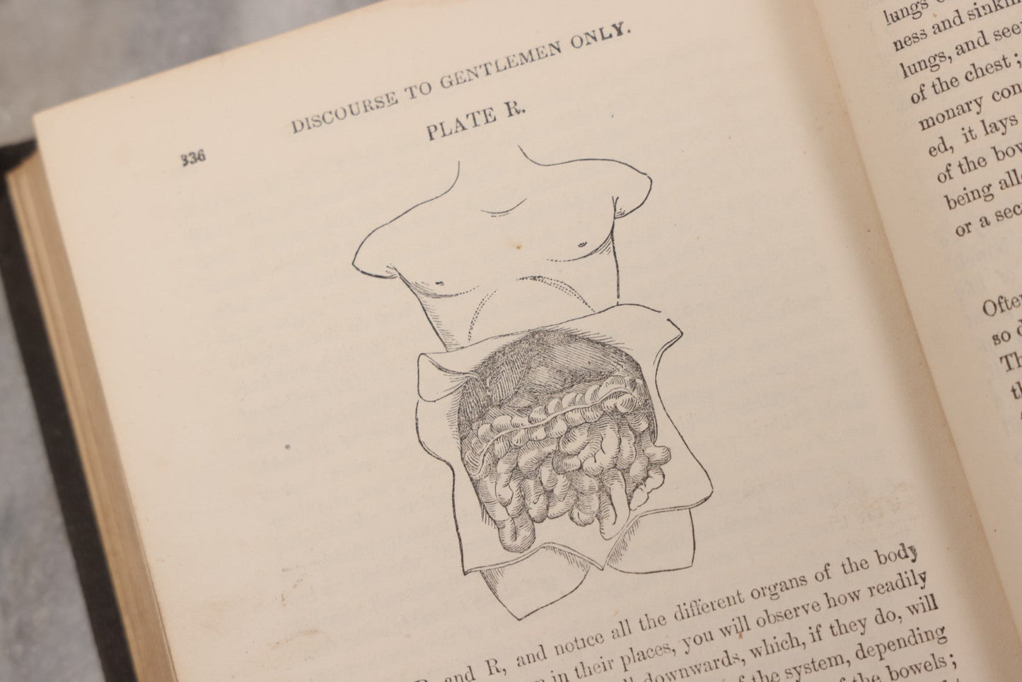 Lot 053 - "Dr. Fitch's Lectures On Consumption: Six Lectures On The Functions Of The Lungs" Antique Medical Book By Samuel Sheldon Fitch, A.M., M.D., With 30 Illustrations, Published By S.S. Fitch & Co., New York, 1959