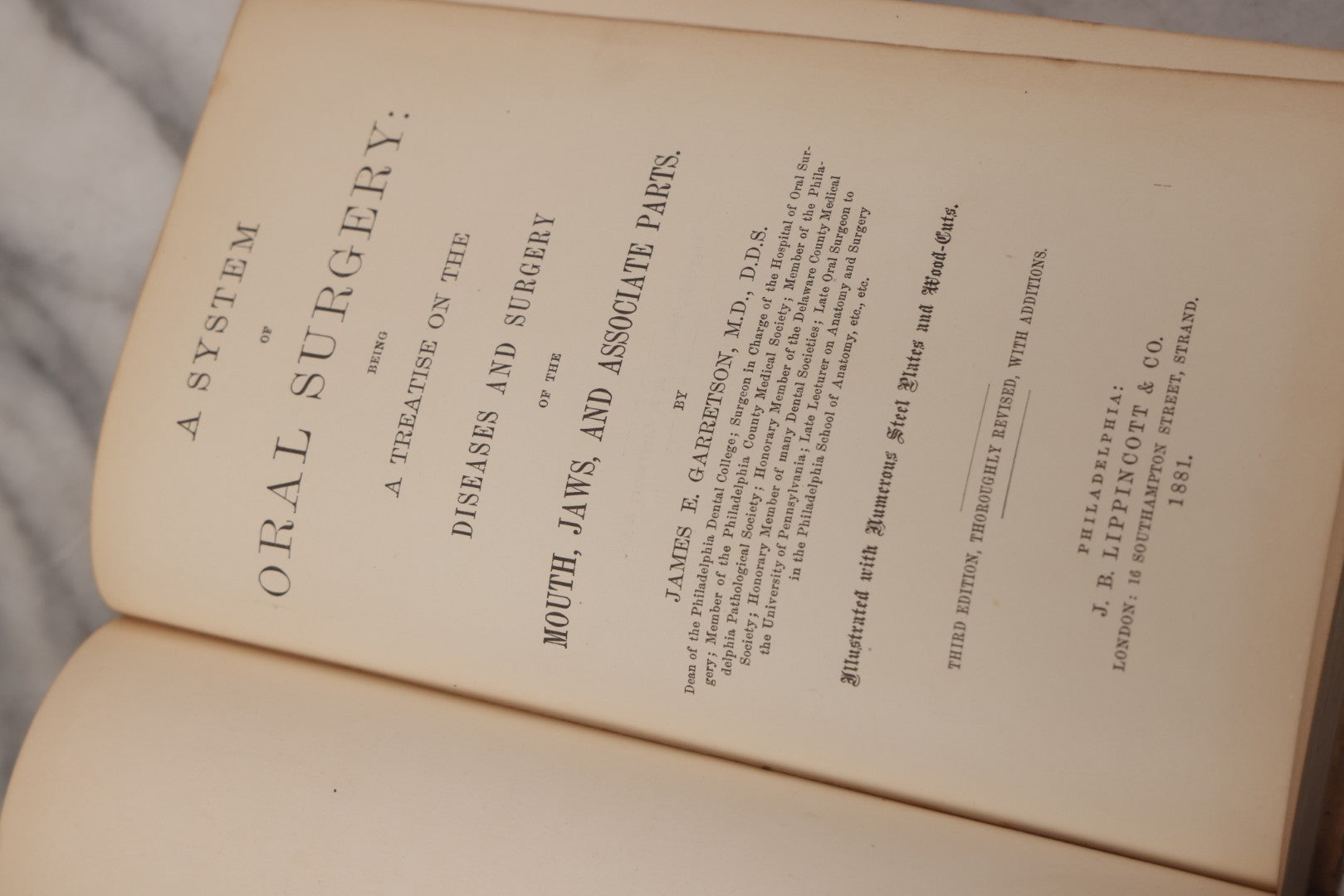 Lot 055 - "A System Of Oral Surgery: Diseases And Surgery Of The Mouth, Jaws, And Associated Parts" Antique Book By James E. Garretson, M.D., Illustrated With Steel Plates And Wood Cuts, 3rd Edition, Published By J.B. Lippincott & Co., Philadelphia, 1881