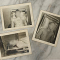 Lot 178 - Grouping Of Three Vintage World War II Snapshot Photographs Depicting Deceased Soldiers With Combat Injuries — Content Warning: Graphic Wartime Imagery