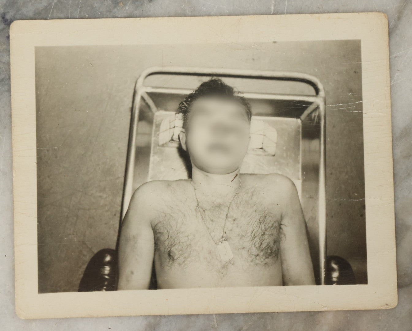 Lot 178 - Grouping Of Three Vintage World War II Snapshot Photographs Depicting Deceased Soldiers With Combat Injuries — Content Warning: Graphic Wartime Imagery