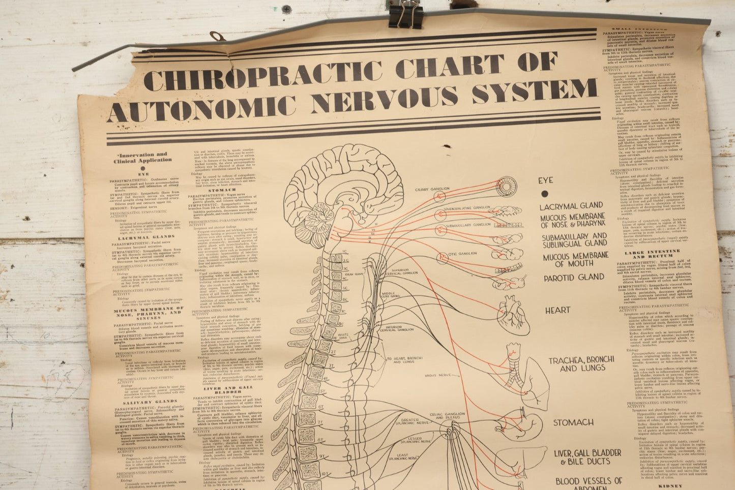 Lot 235 - Vintage Advertising Poster “Chiropractic Chart Of Autonomic Nervous System,” National College Of Chiropractic, Chicago, Illinois, 1938, Note Poor Condition 24" x 35-1/2"