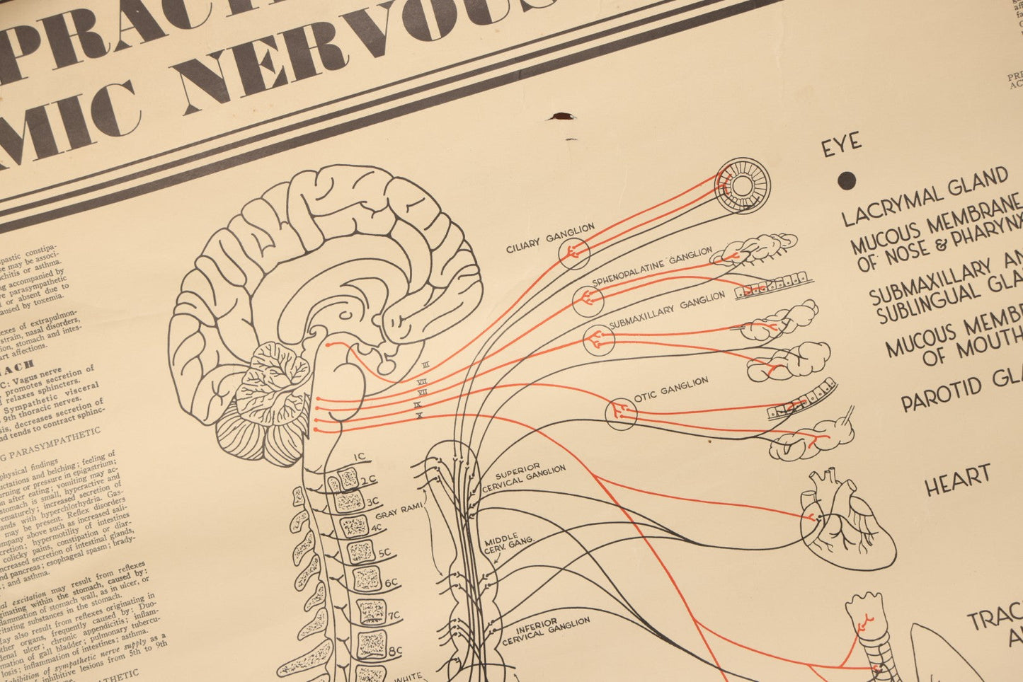 Lot 235 - Vintage Advertising Poster “Chiropractic Chart Of Autonomic Nervous System,” National College Of Chiropractic, Chicago, Illinois, 1938, Note Poor Condition 24" x 35-1/2"