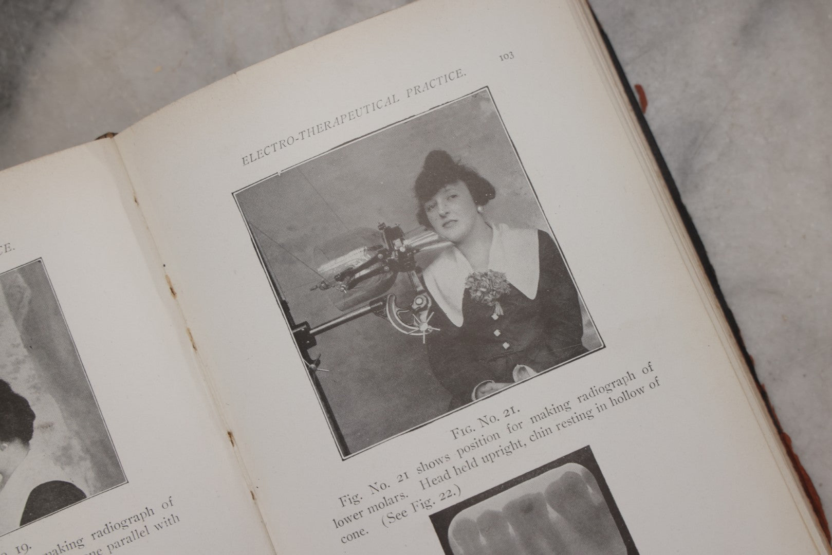 Lot 217 - "Electro-Therapeutical Practice; A Ready Reference Guide For Physicians In The Use Of Electricity And The X-Rays" By Chas. S. Neiswanger, M.D., 1918
