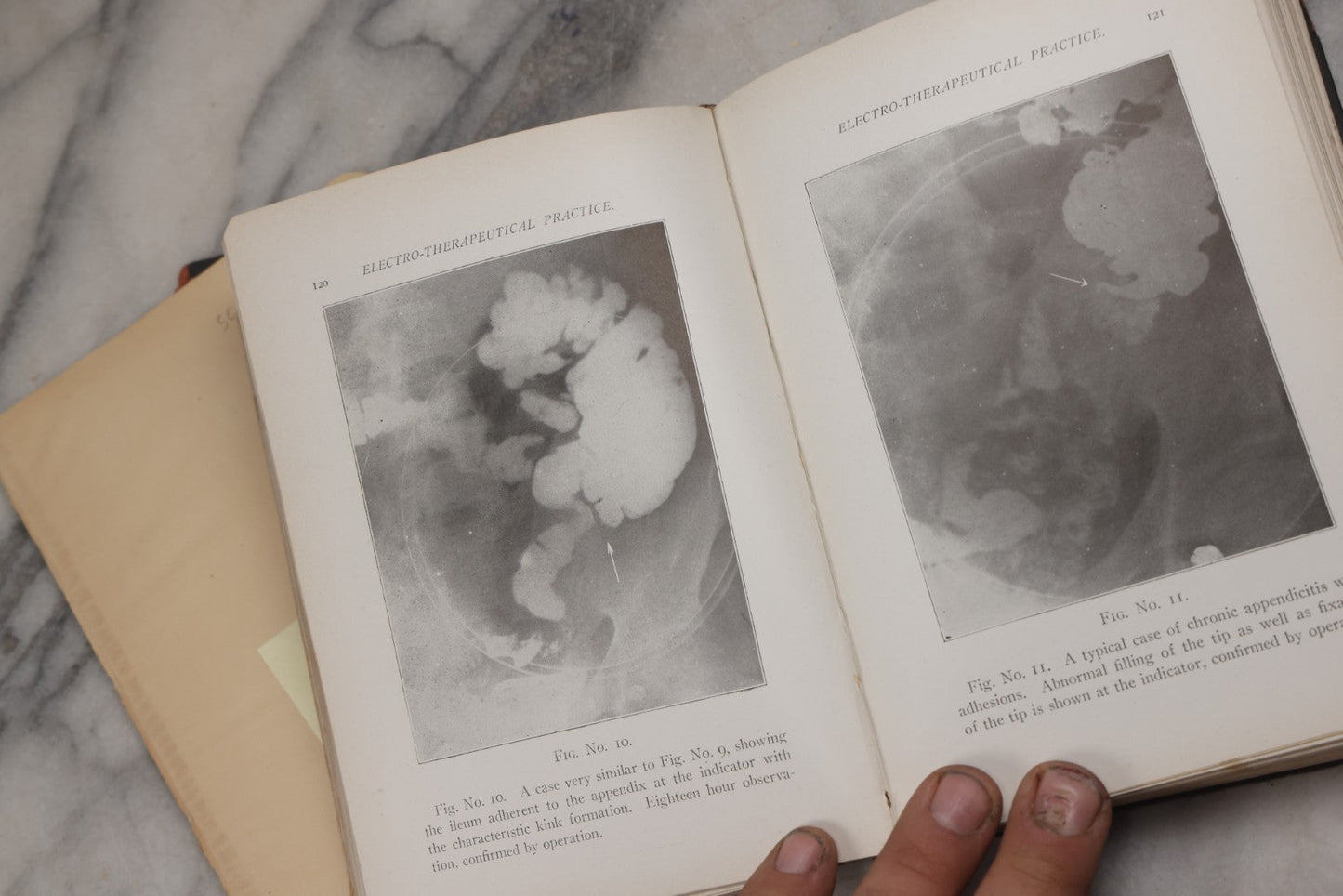 Lot 217 - "Electro-Therapeutical Practice; A Ready Reference Guide For Physicians In The Use Of Electricity And The X-Rays" By Chas. S. Neiswanger, M.D., 1918