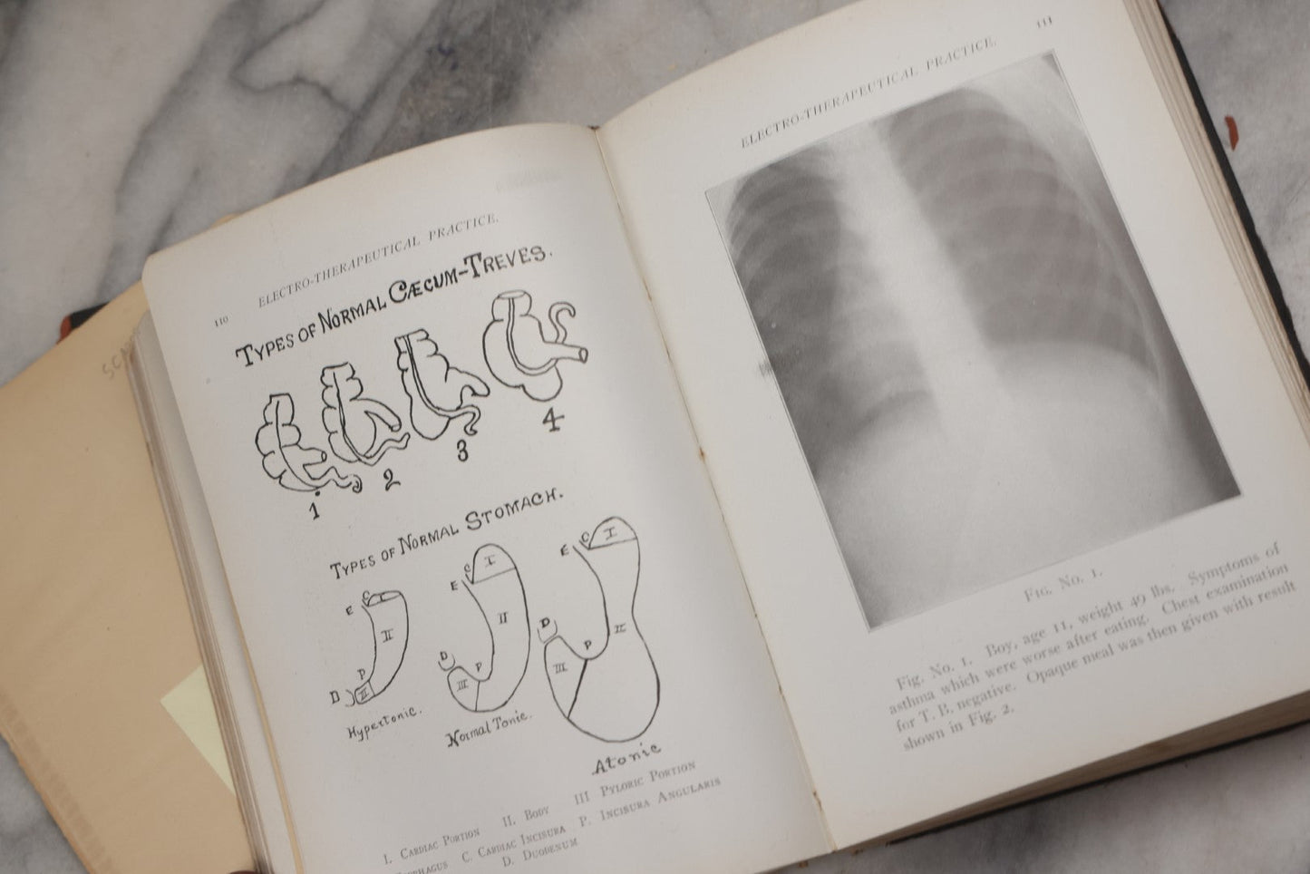 Lot 217 - "Electro-Therapeutical Practice; A Ready Reference Guide For Physicians In The Use Of Electricity And The X-Rays" By Chas. S. Neiswanger, M.D., 1918
