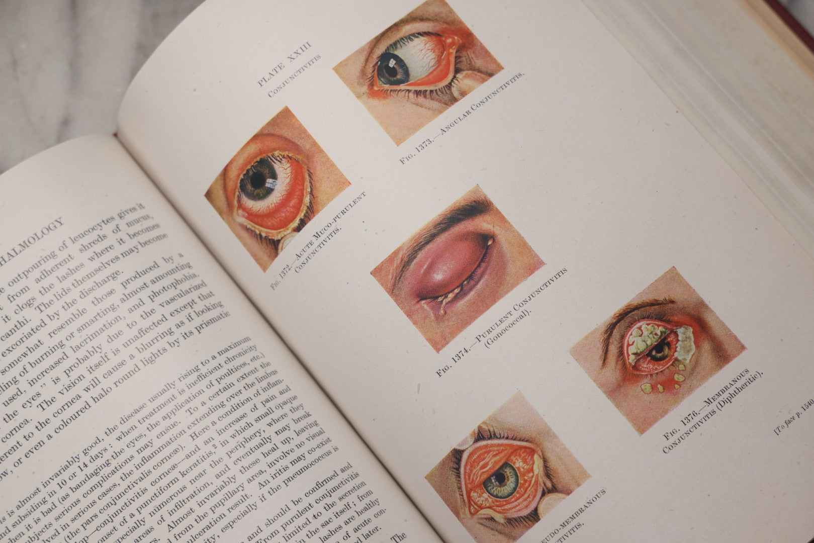 Lot 218 - "Text-Book Of Ophthalmology, Volume II" Vintage Illustrated Medical Reference By Sir W. Stewart Duke-Elder, The C. V. Mosby Company, 1944