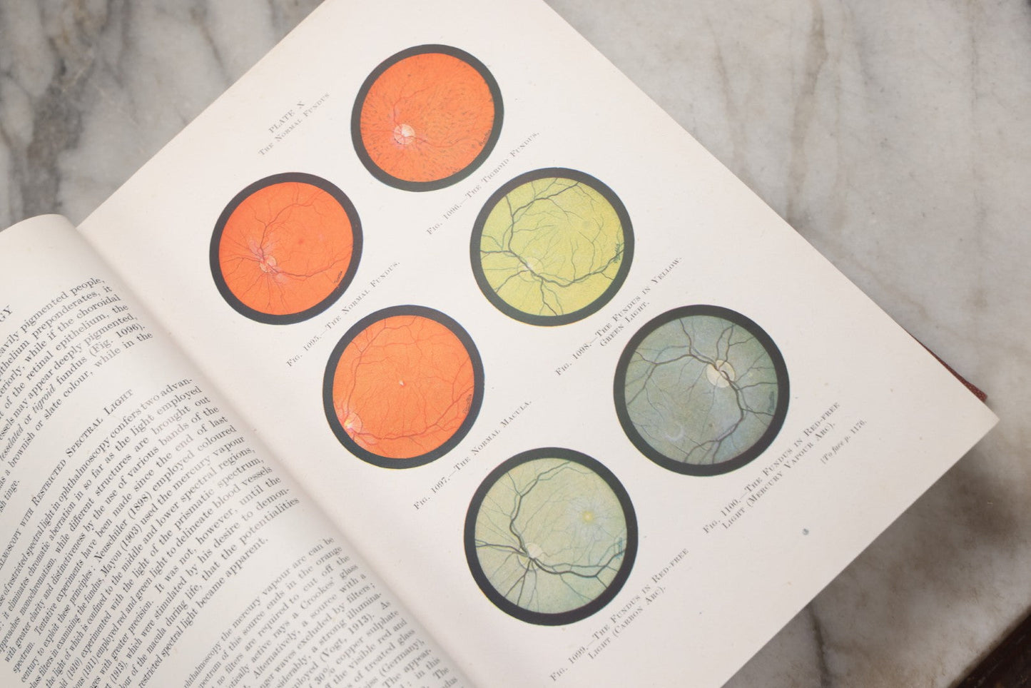 Lot 218 - "Text-Book Of Ophthalmology, Volume II" Vintage Illustrated Medical Reference By Sir W. Stewart Duke-Elder, The C. V. Mosby Company, 1944