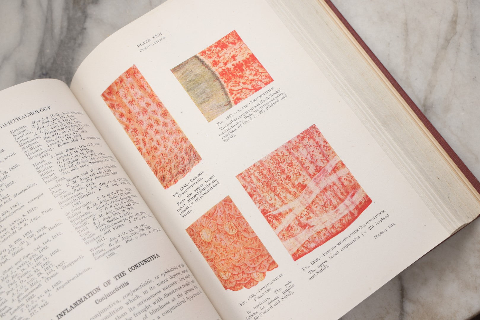 Lot 218 - "Text-Book Of Ophthalmology, Volume II" Vintage Illustrated Medical Reference By Sir W. Stewart Duke-Elder, The C. V. Mosby Company, 1944