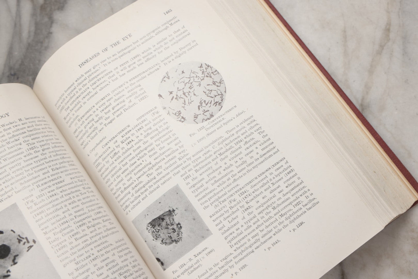 Lot 218 - "Text-Book Of Ophthalmology, Volume II" Vintage Illustrated Medical Reference By Sir W. Stewart Duke-Elder, The C. V. Mosby Company, 1944
