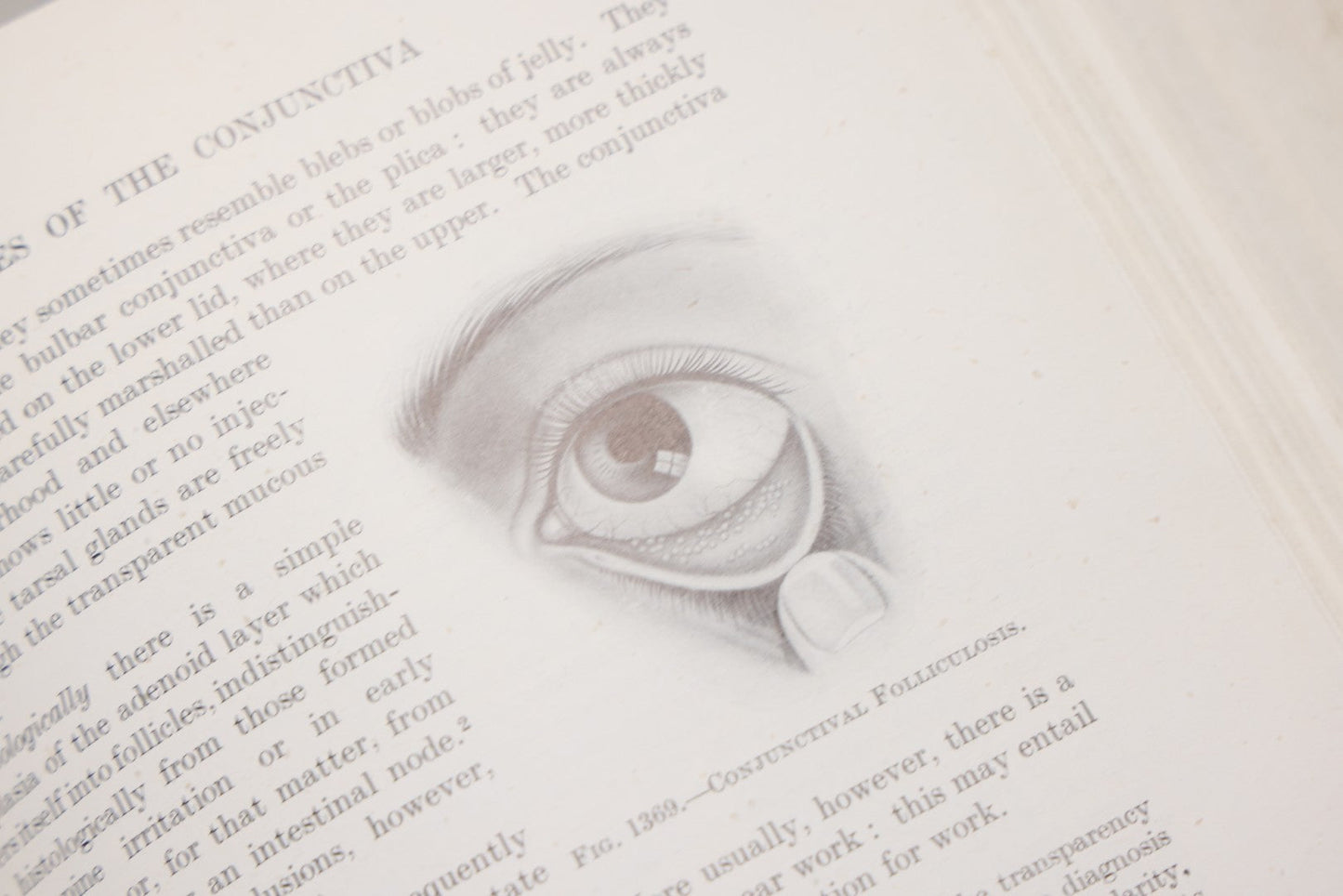 Lot 218 - "Text-Book Of Ophthalmology, Volume II" Vintage Illustrated Medical Reference By Sir W. Stewart Duke-Elder, The C. V. Mosby Company, 1944