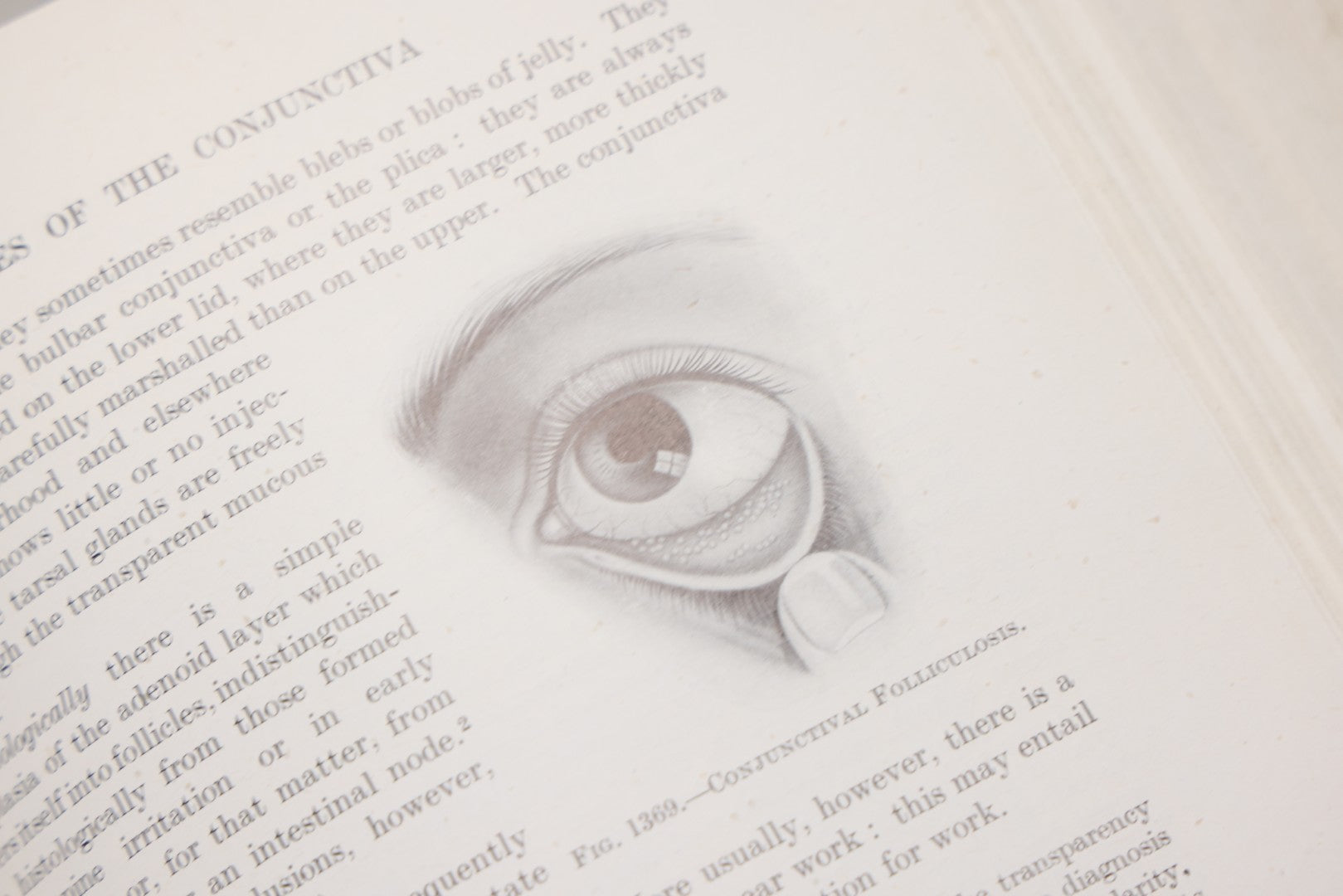 Lot 218 - "Text-Book Of Ophthalmology, Volume II" Vintage Illustrated Medical Reference By Sir W. Stewart Duke-Elder, The C. V. Mosby Company, 1944