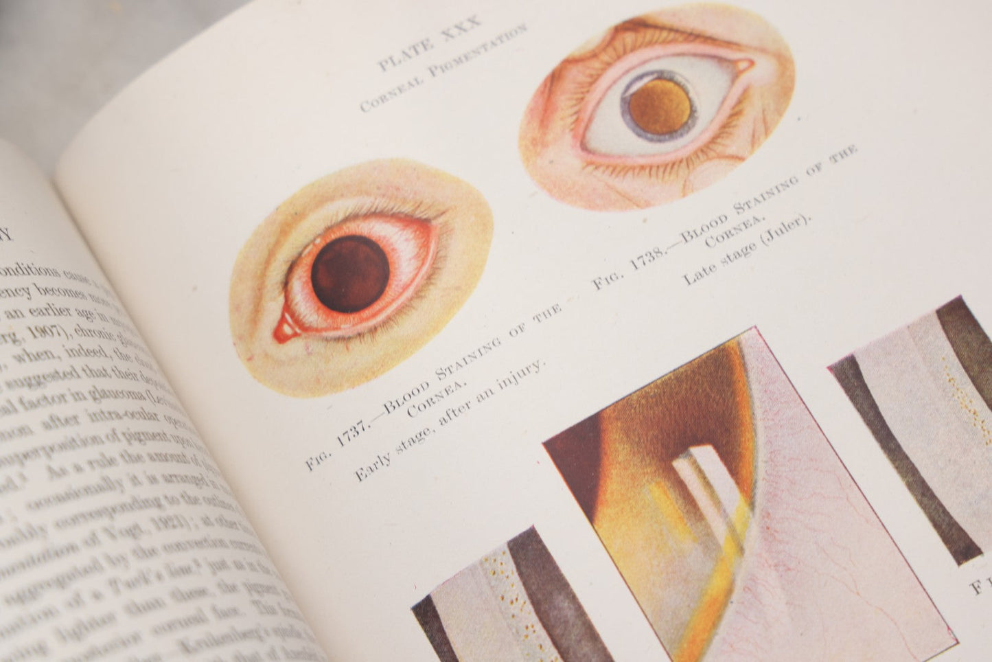 Lot 218 - "Text-Book Of Ophthalmology, Volume II" Vintage Illustrated Medical Reference By Sir W. Stewart Duke-Elder, The C. V. Mosby Company, 1944