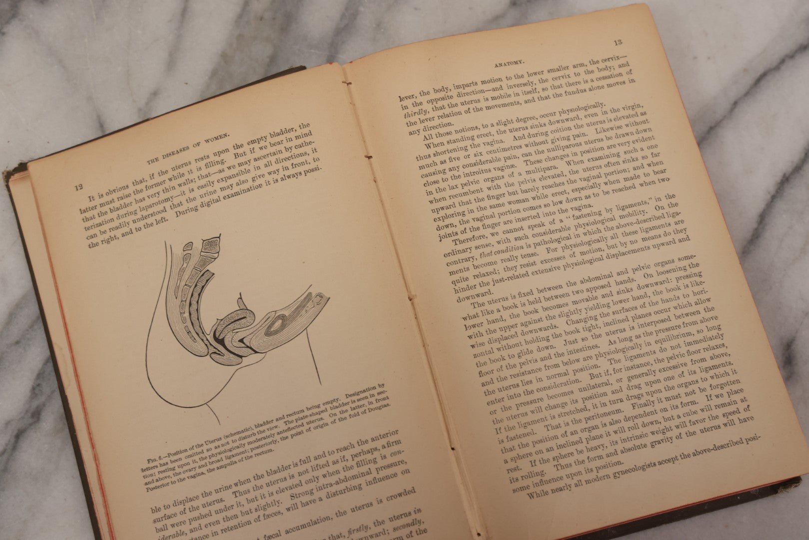 Lot 233 - "The Diseases Of Women" Antique Gynecology And Obstetrics Medical Book By Heinrich Fritsch, Translated By Isidor Furst, Published By William Wood & Company, New York, 1883, With 159 Wood Engravings