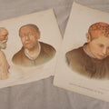 Lot 230 - Pair Of Antique Medical Chromolithograph Book Plate Prints, "Leprosy" And "Kerion And Ringworm Of Head," Lea Brothers & Co., Lithographed By T. Sinclair & Son, Philadelphia, Pennsylvania