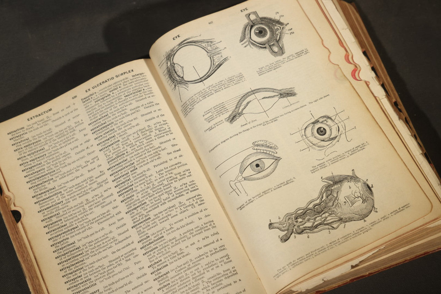"The American Illustrated Medical Dictionary" Vintage Illustrated Medical Reference Book by W.A. Newman Dorland, 13th Edition, Published by W.B. Saunders Company, Philadelphia, Pennsylvania