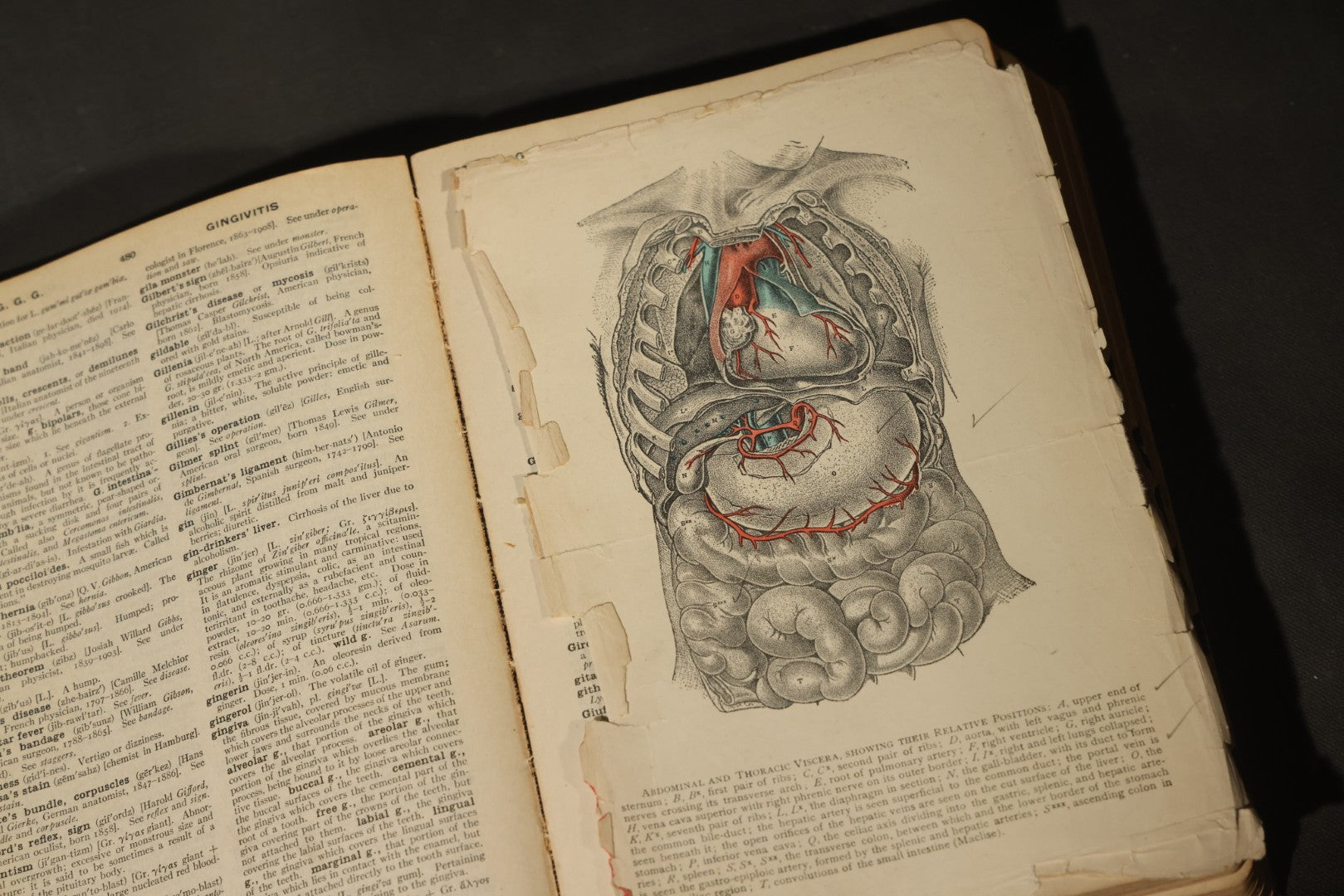 "The American Illustrated Medical Dictionary" Vintage Illustrated Medical Reference Book by W.A. Newman Dorland, 13th Edition, Published by W.B. Saunders Company, Philadelphia, Pennsylvania