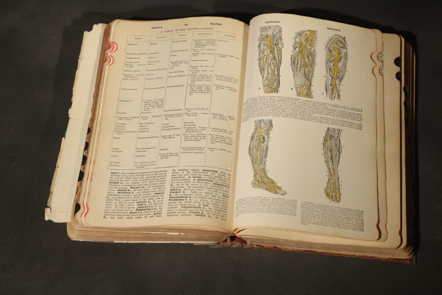 "The American Illustrated Medical Dictionary" Vintage Illustrated Medical Reference Book by W.A. Newman Dorland, 13th Edition, Published by W.B. Saunders Company, Philadelphia, Pennsylvania