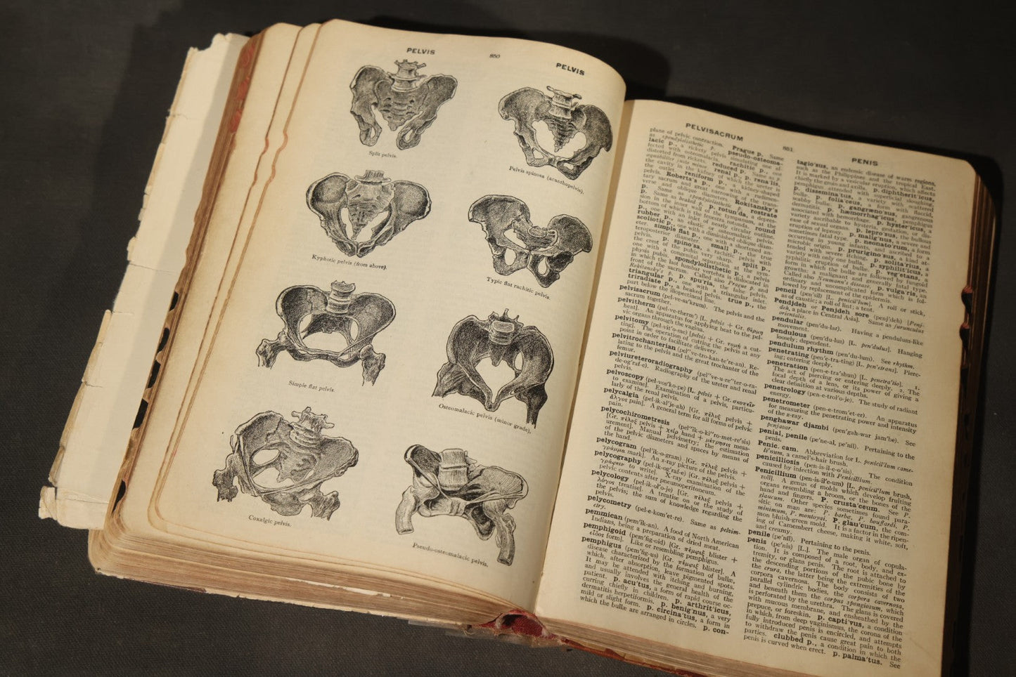 "The American Illustrated Medical Dictionary" Vintage Illustrated Medical Reference Book by W.A. Newman Dorland, 13th Edition, Published by W.B. Saunders Company, Philadelphia, Pennsylvania