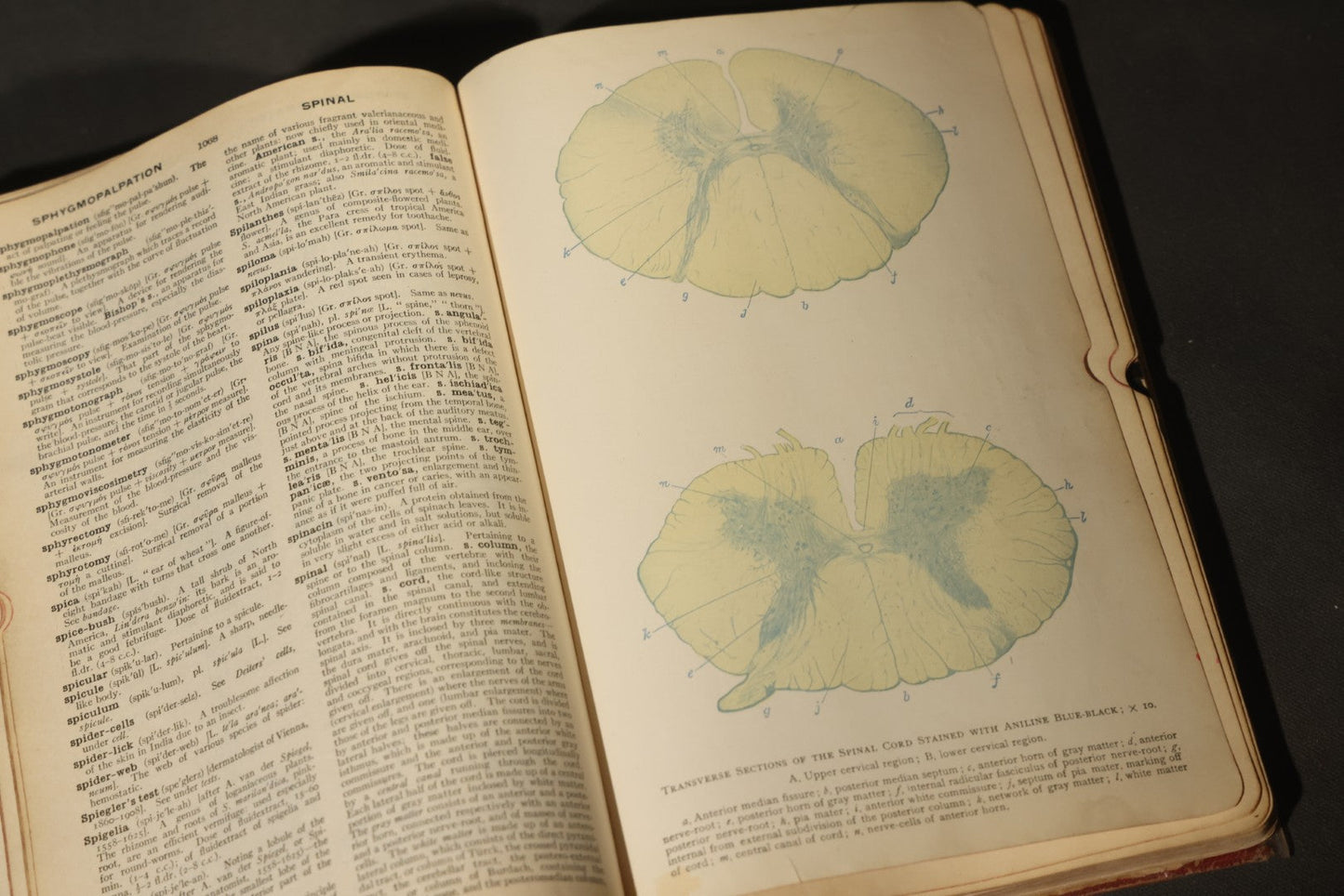 "The American Illustrated Medical Dictionary" Vintage Illustrated Medical Reference Book by W.A. Newman Dorland, 13th Edition, Published by W.B. Saunders Company, Philadelphia, Pennsylvania