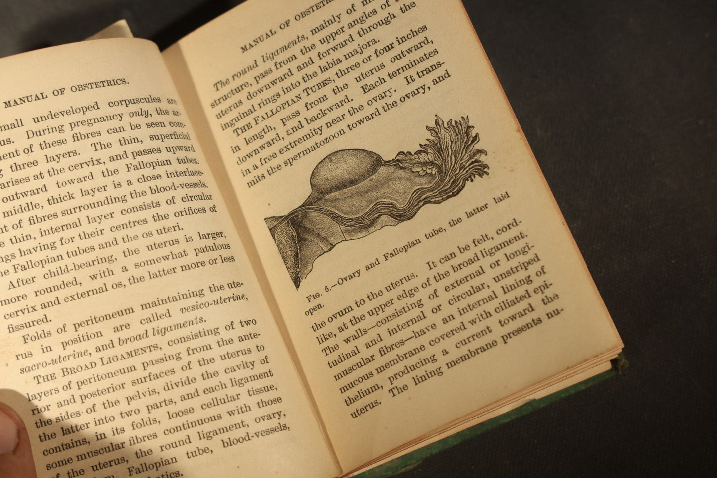 "A Manual of Obstetrics" Antique Illustrated Medical Book by Edward L. Partridge, M.D., Published by William Wood & Company, New York, 1884