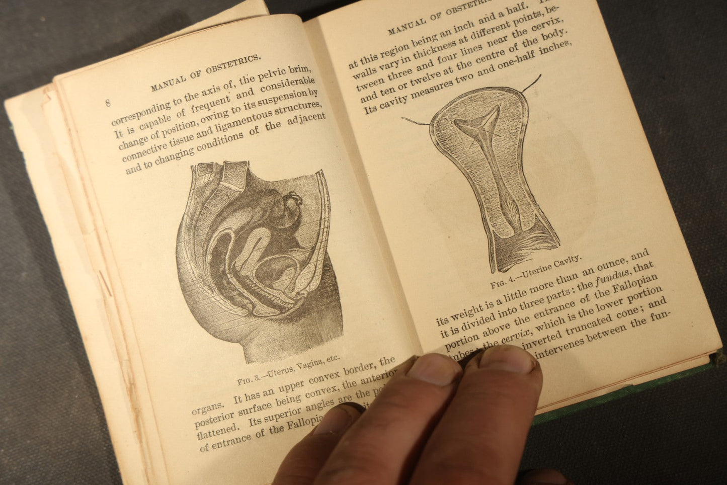 "A Manual of Obstetrics" Antique Illustrated Medical Book by Edward L. Partridge, M.D., Published by William Wood & Company, New York, 1884