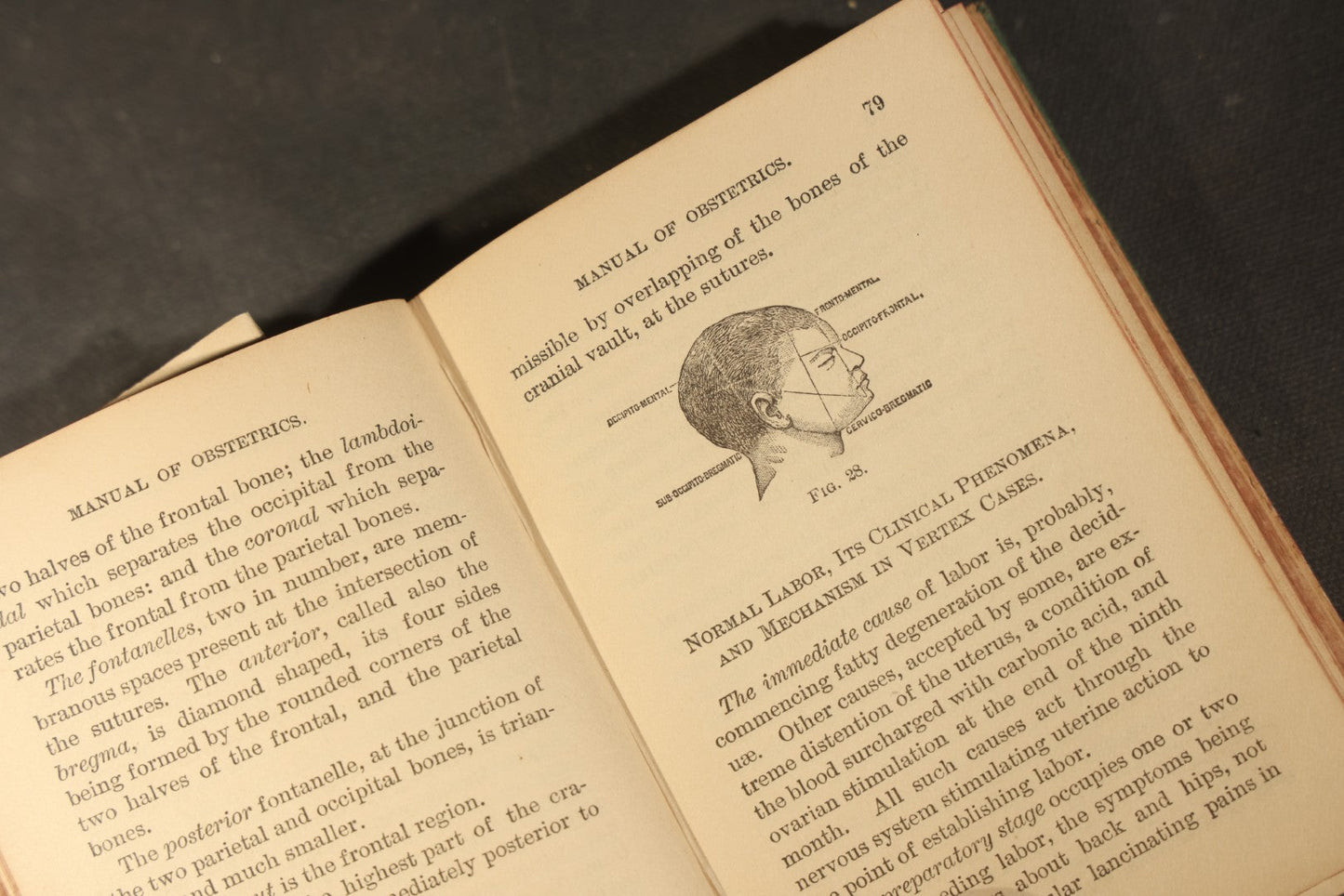 "A Manual of Obstetrics" Antique Illustrated Medical Book by Edward L. Partridge, M.D., Published by William Wood & Company, New York, 1884