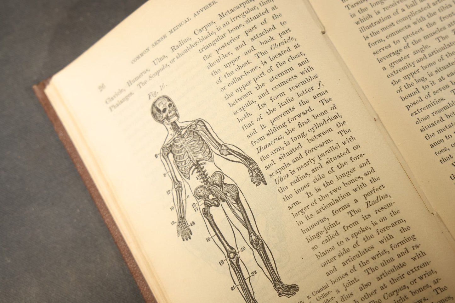 "The People's Common Sense Medical Adviser in Plain English; or, Medicine Simplified" Antique Medical Book with Anatomical Illustrations by R.V. Pierce, M.D., 18th Edition, Published by World's Dispensary Printing Office, Buffalo, New York, 1888