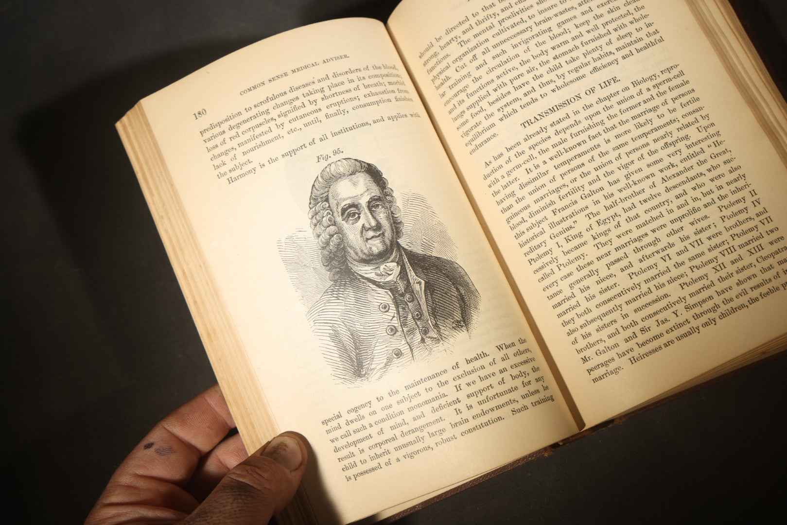 "The People's Common Sense Medical Adviser in Plain English; or, Medicine Simplified" Antique Medical Book with Anatomical Illustrations by R.V. Pierce, M.D., 18th Edition, Published by World's Dispensary Printing Office, Buffalo, New York, 1888