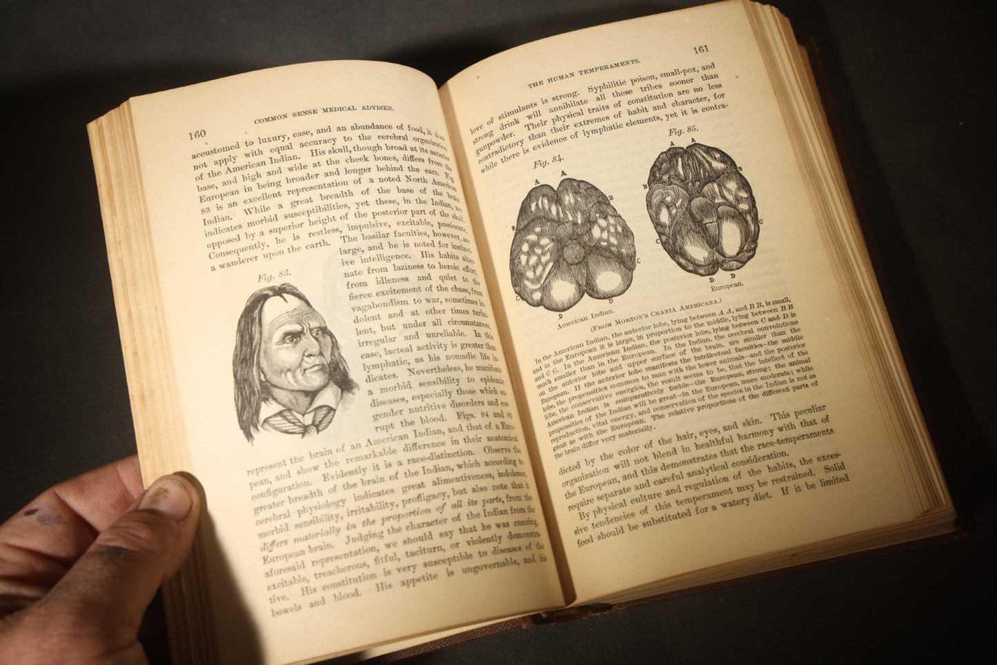 "The People's Common Sense Medical Adviser in Plain English; or, Medicine Simplified" Antique Medical Book with Anatomical Illustrations by R.V. Pierce, M.D., 18th Edition, Published by World's Dispensary Printing Office, Buffalo, New York, 1888