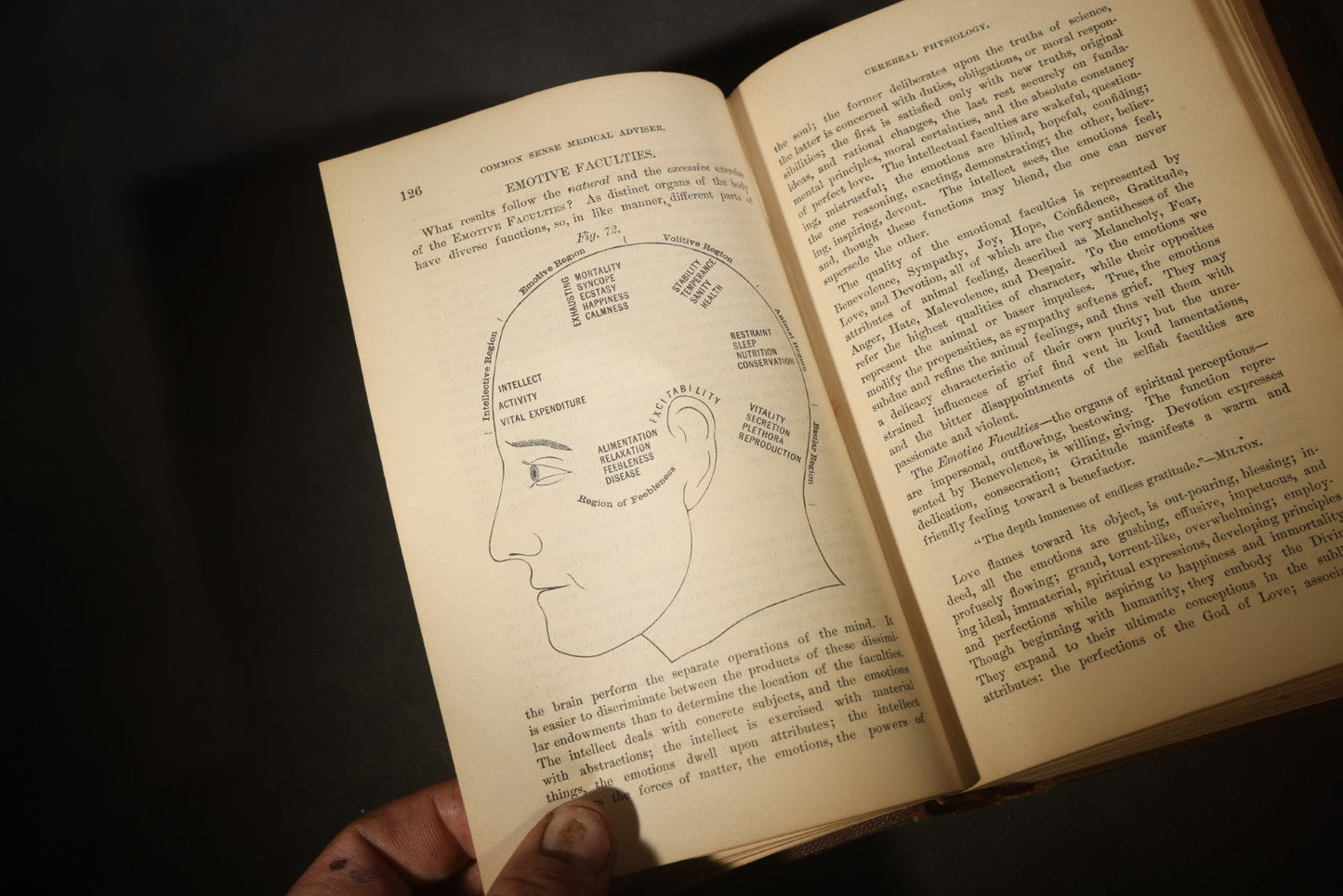 "The People's Common Sense Medical Adviser in Plain English; or, Medicine Simplified" Antique Medical Book with Anatomical Illustrations by R.V. Pierce, M.D., 18th Edition, Published by World's Dispensary Printing Office, Buffalo, New York, 1888
