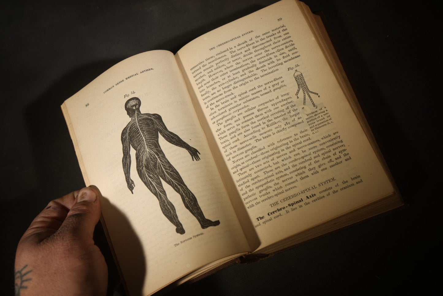 "The People's Common Sense Medical Adviser in Plain English; or, Medicine Simplified" Antique Medical Book with Anatomical Illustrations by R.V. Pierce, M.D., 18th Edition, Published by World's Dispensary Printing Office, Buffalo, New York, 1888