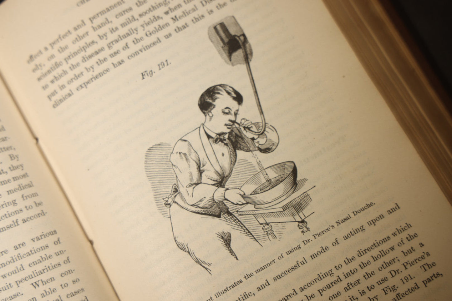 "The People's Common Sense Medical Adviser in Plain English; or, Medicine Simplified" Antique Medical Book with Anatomical Illustrations by R.V. Pierce, M.D., 18th Edition, Published by World's Dispensary Printing Office, Buffalo, New York, 1888