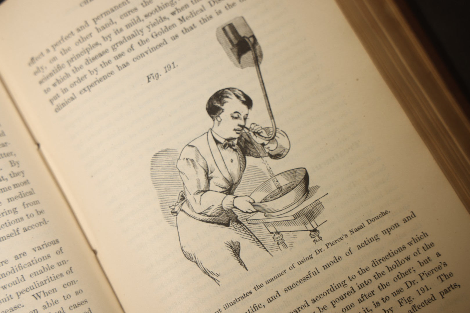 "The People's Common Sense Medical Adviser in Plain English; or, Medicine Simplified" Antique Medical Book with Anatomical Illustrations by R.V. Pierce, M.D., 18th Edition, Published by World's Dispensary Printing Office, Buffalo, New York, 1888
