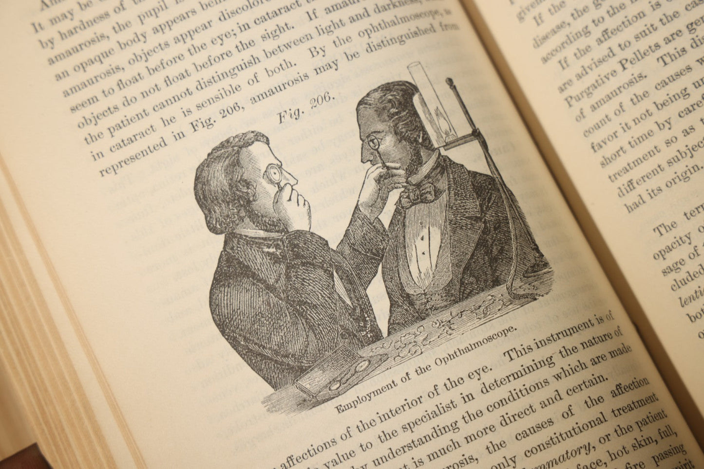 "The People's Common Sense Medical Adviser in Plain English; or, Medicine Simplified" Antique Medical Book with Anatomical Illustrations by R.V. Pierce, M.D., 18th Edition, Published by World's Dispensary Printing Office, Buffalo, New York, 1888