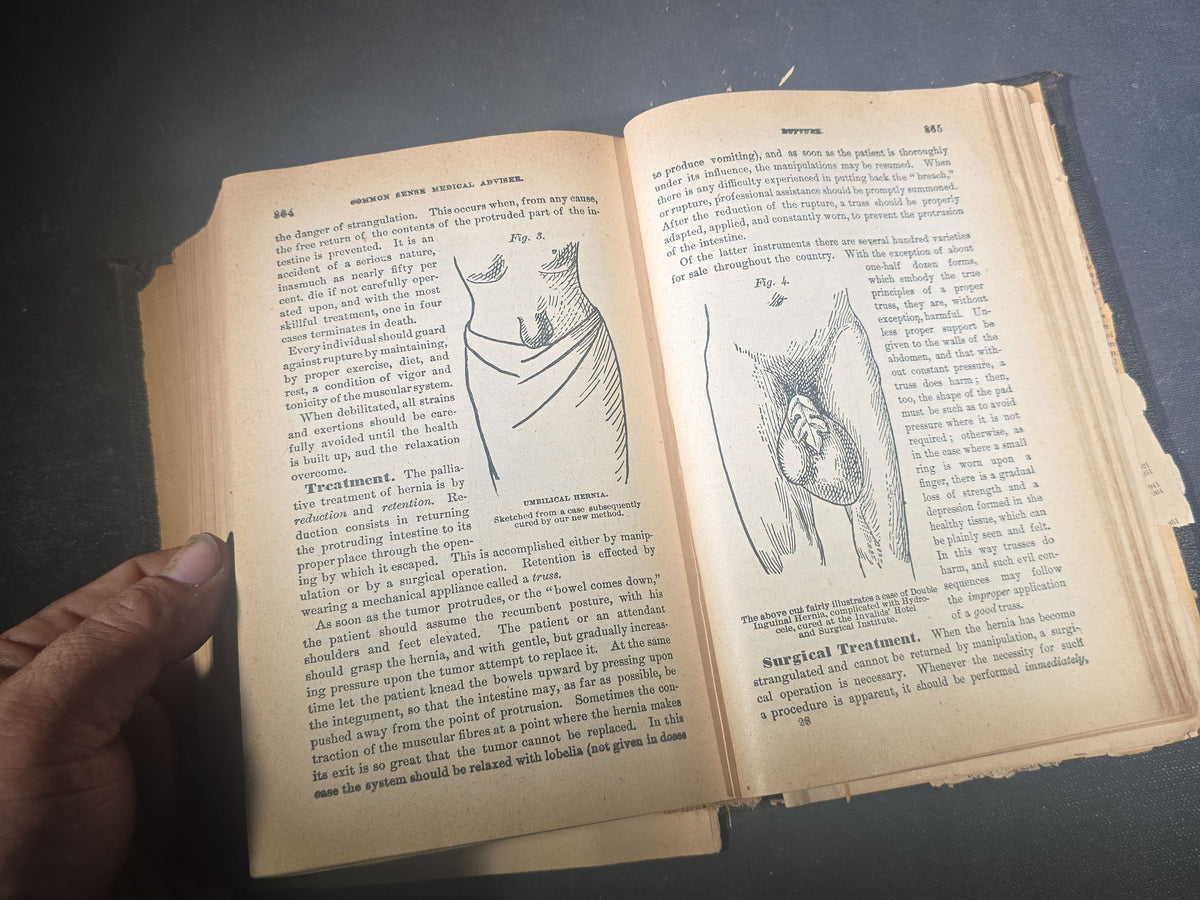 "The People's Common Sense Medical Adviser in Plain English" Antique Medical Book by R. V. Pierce, M.D., Fortieth Edition, Published by World's Dispensary Printing Office and Bindery, Buffalo, New York, 1885