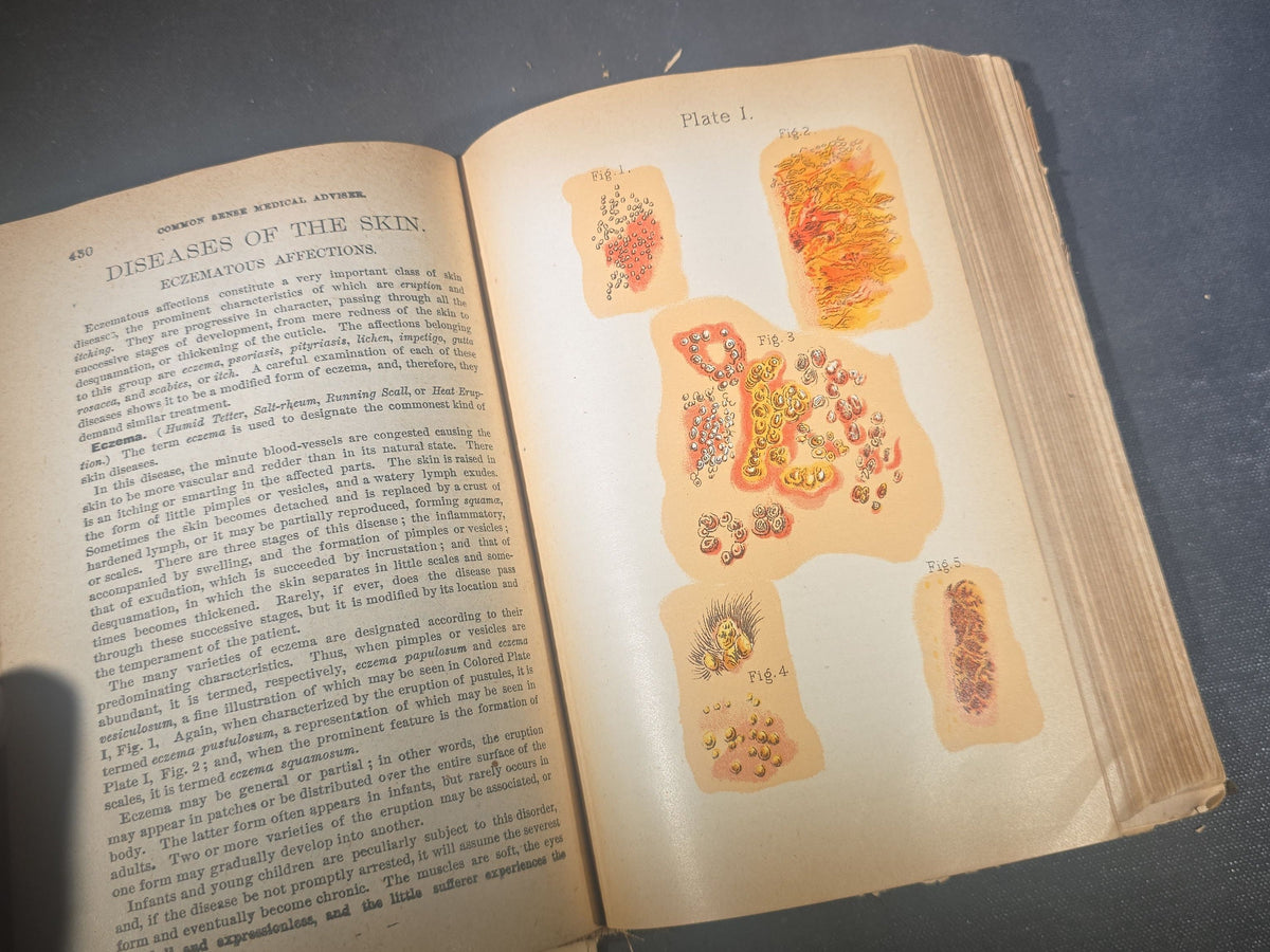 "The People's Common Sense Medical Adviser in Plain English" Antique Medical Book by R. V. Pierce, M.D., Fortieth Edition, Published by World's Dispensary Printing Office and Bindery, Buffalo, New York, 1885