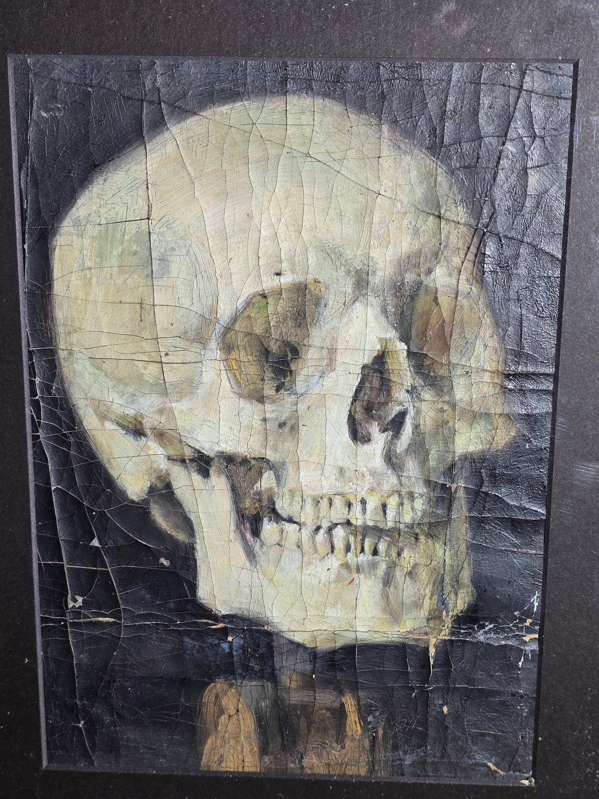 Vintage Oil Painting on Canvas, Human Skull Study Against a Dark Background, Unsigned, in Modern Frame