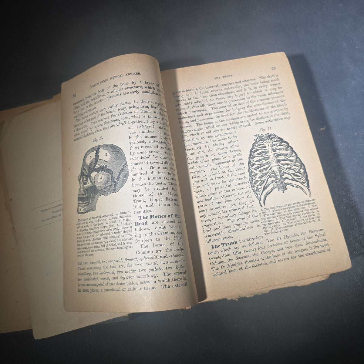 "The People's Common Sense Medical Adviser in Plain English" Antique Medical Book by R. V. Pierce, M.D., Fortieth Edition, Published by World's Dispensary Printing Office and Bindery, Buffalo, New York, 1885