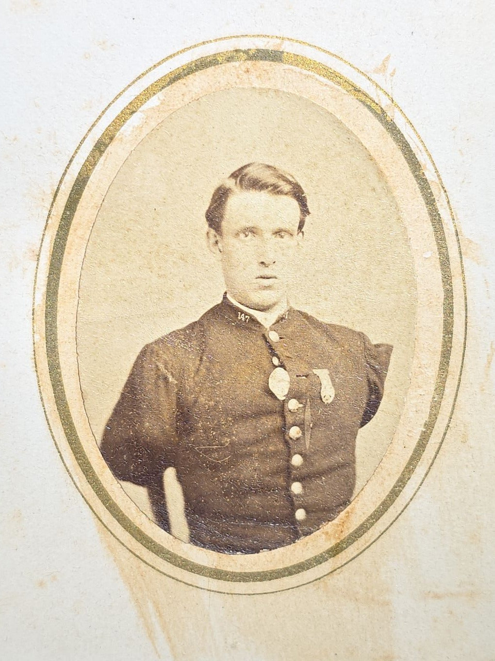 Antique Carte De Visite C.D.V. Photograph of Civil War Double Amputee Sergeant Alfred Stratton, Company G, 147th New York Infantry